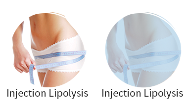 Injection lipolysis 